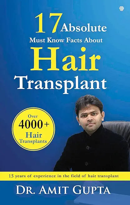 17 Absolute Must Know Facts About Hair Transplant